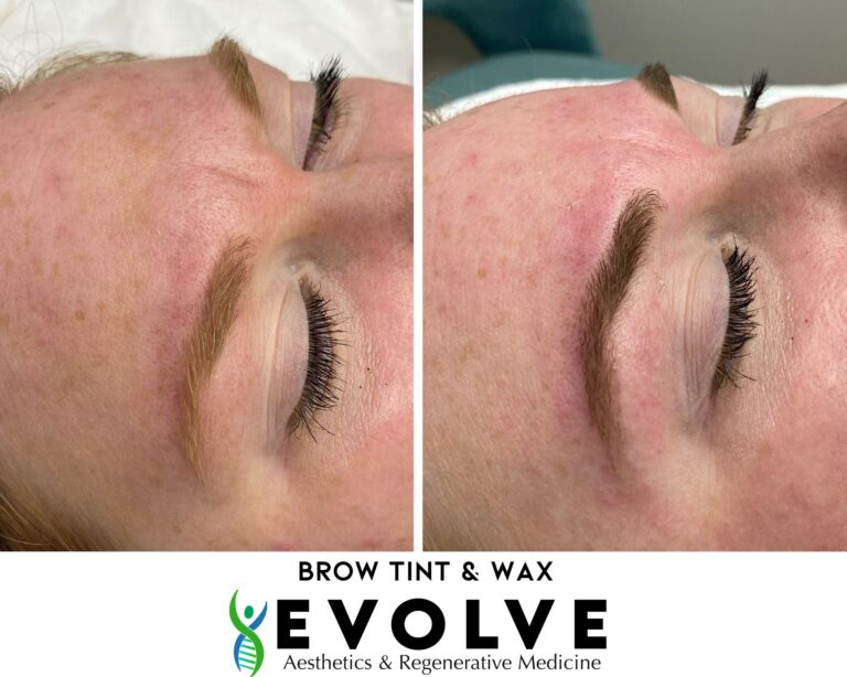 Brow Tint and Wax Before and After Photos | Evolve Aesthetics and Regenerative Medicine in Waterloo, IA