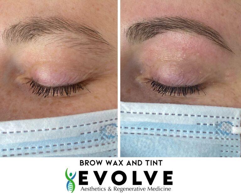 Brow Wax and Tint Before and After Photos | Evolve Aesthetics and Regenerative Medicine in Waterloo, IA
