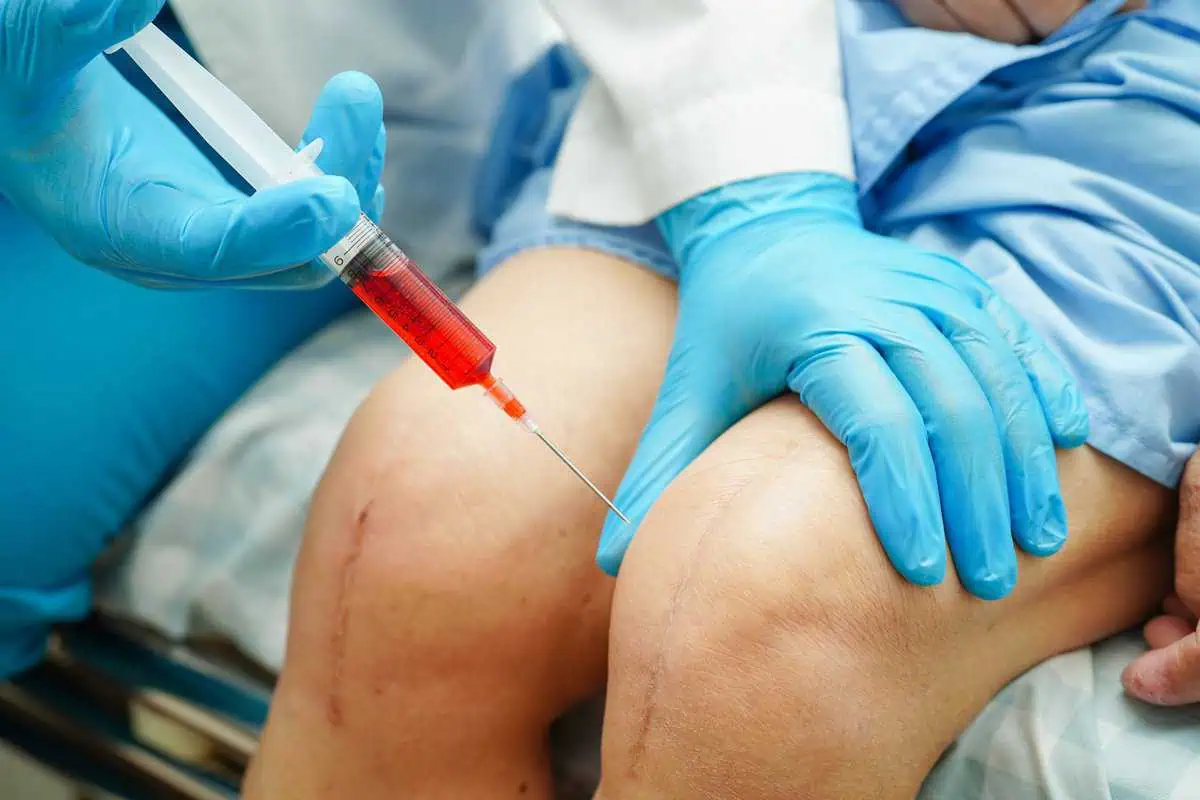 PRP Joint Therapy by Evolve Aesthetics and Regenerative Medicine in Waterloo, Lowa