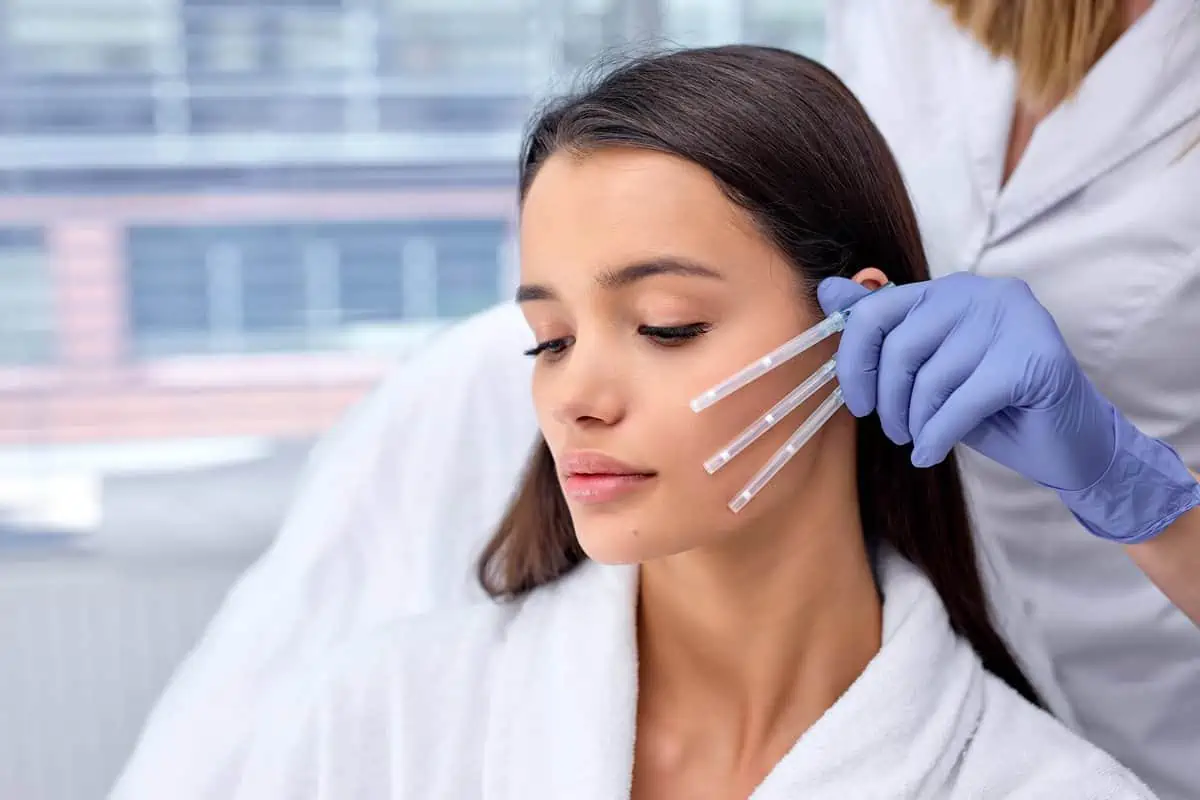 Woman receiving PDO thread lift treatment on her cheek in Waterloo IA