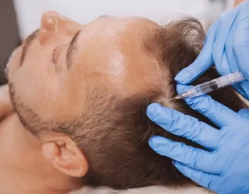 PRP Hair Restoration by Evolve Aesthetics in Waterloo IA