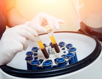 PRP by Evolve Aesthetics in Waterloo IA