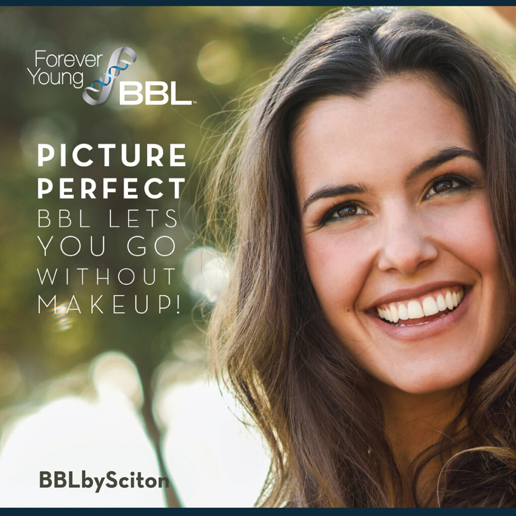 FYBBL Ad NoFilterNeeded-PicturePerfect April19'18